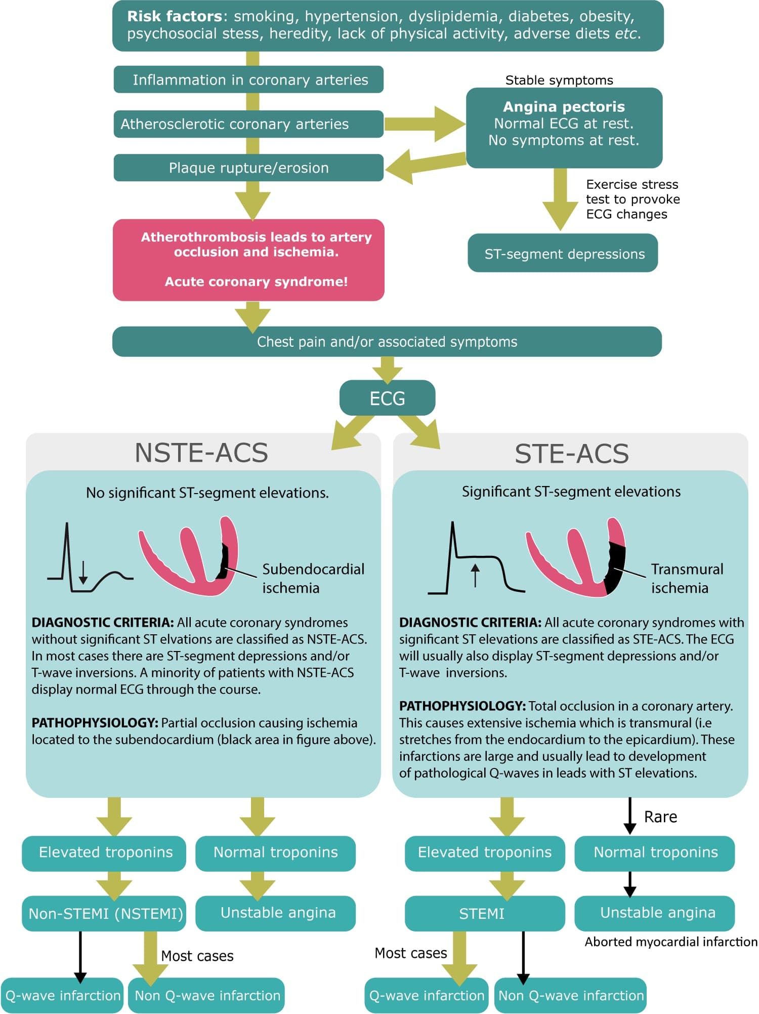 acute myocardial infarction coronary syndromes stemi nstemi angina