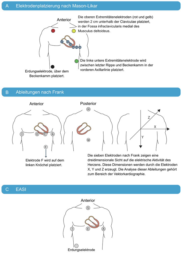 Abbildung 24. Alternative EKG-Ableitungssysteme.