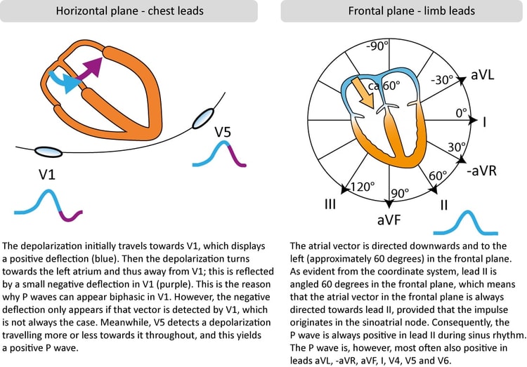 Figure 2. P-wave morphology in chest and limb leads.