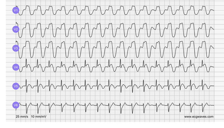 EKG-Testbibliothek: Frage 1, EKG 2
