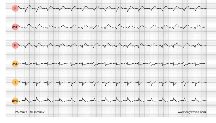 EKG-Testbibliothek: Frage 1