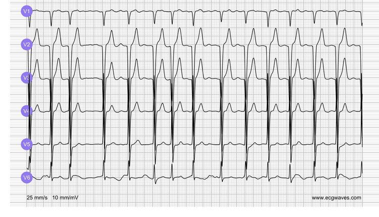 EKG-Testbibliothek: Frage 2