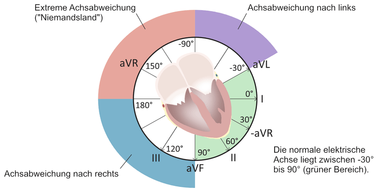Abbildung 38. Die elektrische Achse des Herzens.