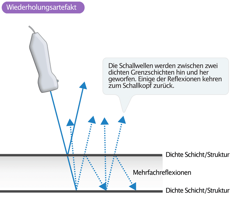 Abbildung 2. Wiederholungsartefakt.
