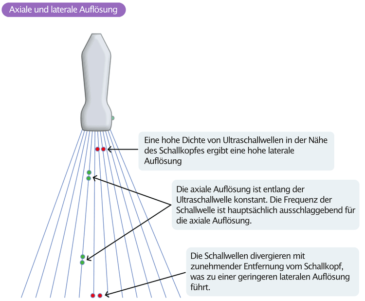 Abbildung 5. Axiale und laterale Auflösung des Ultraschallbildes.