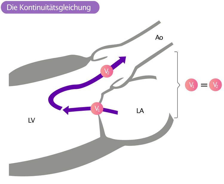 Abbildung 2. Das Prinzip der Kontinuität (die Kontinuitätsgleichung) besagt, dass das Volumen des Blutes, das durch die Mitralklappe fließt, dem Volumen entsprechen muss, das durch die Aortenklappe fließt.