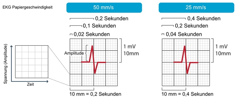 Abbildung 1. Das EKG-Raster. Die x-Achse repräsentiert die Zeit und die y-Achse repräsentiert die Amplitude der im Myokard erzeugten elektrischen Signale. Das gleiche EKG-Raster wird bei Kindern und erwachsenen Patienten angewendet.