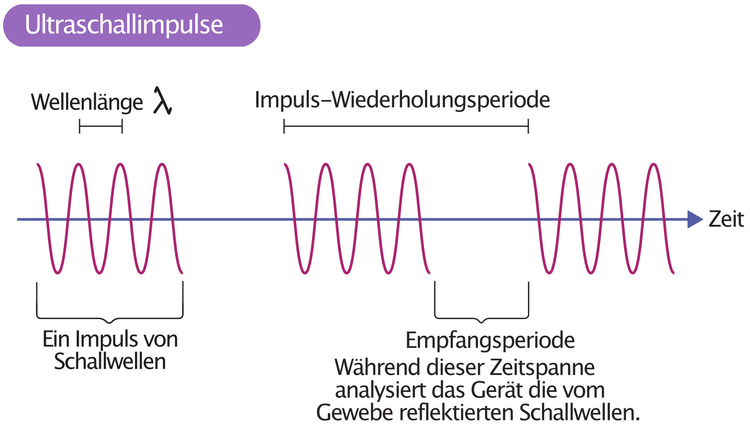 Abbildung 1. Das Ultraschallgerät sendet Ultraschallimpulse und empfängt die reflektierten Ultraschallwellen zwischen den Impulsen.