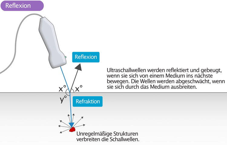 Figure 4. Reflexion und Brechung von Ultraschallwellen.