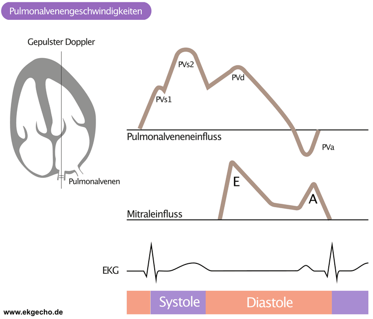 Figure 5. Messung der Pulmonalvenengeschwindigkeiten mit dem gepulsten Doppler. 