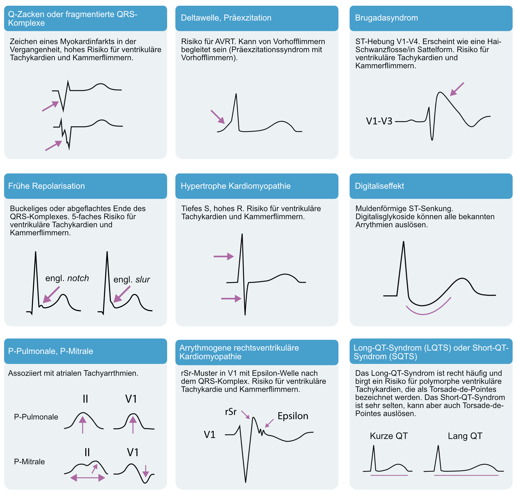 Illustration ur kursen EKG-Test 7