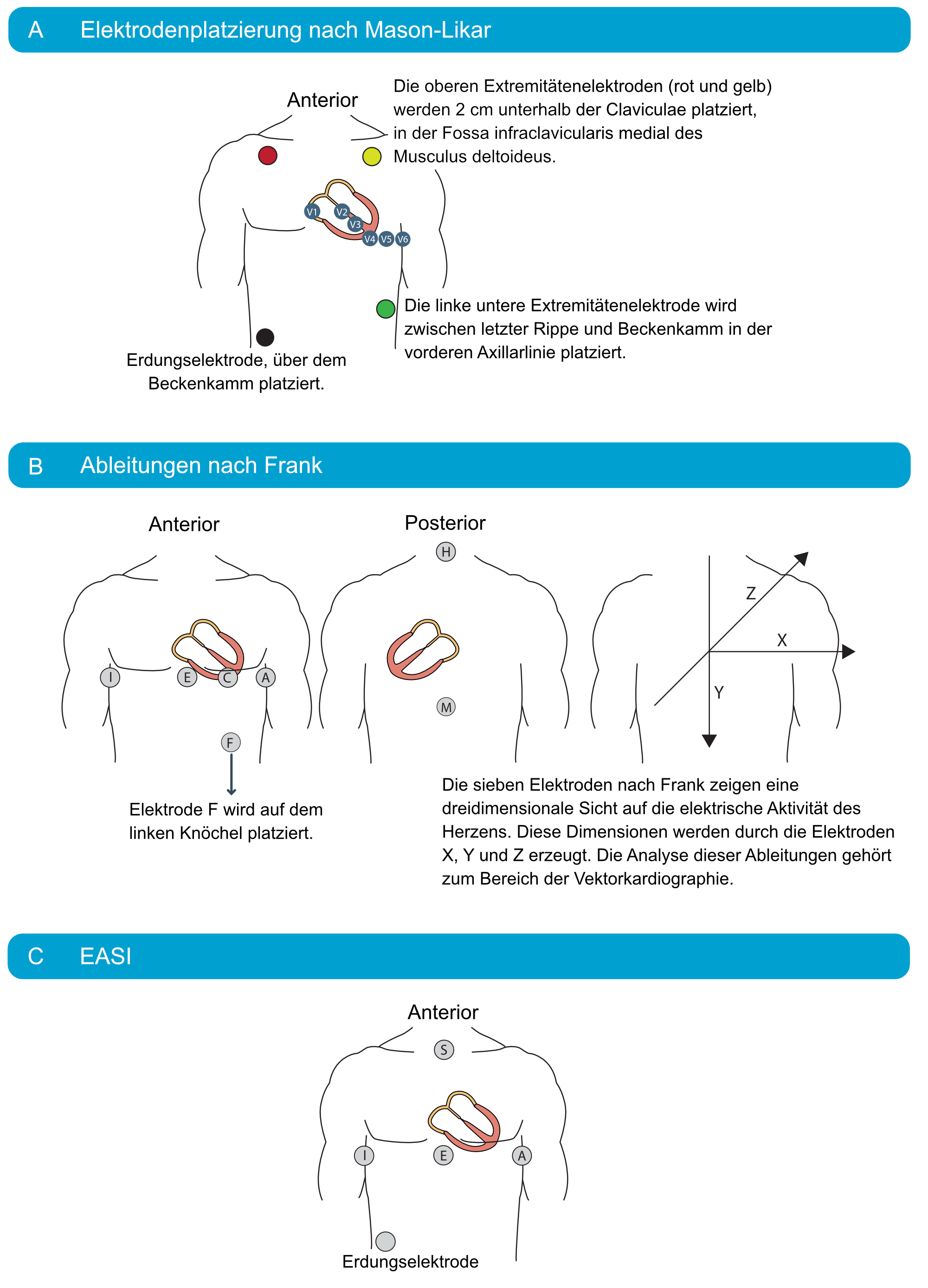 Abbildung 24. Alternative EKG-Ableitungssysteme.