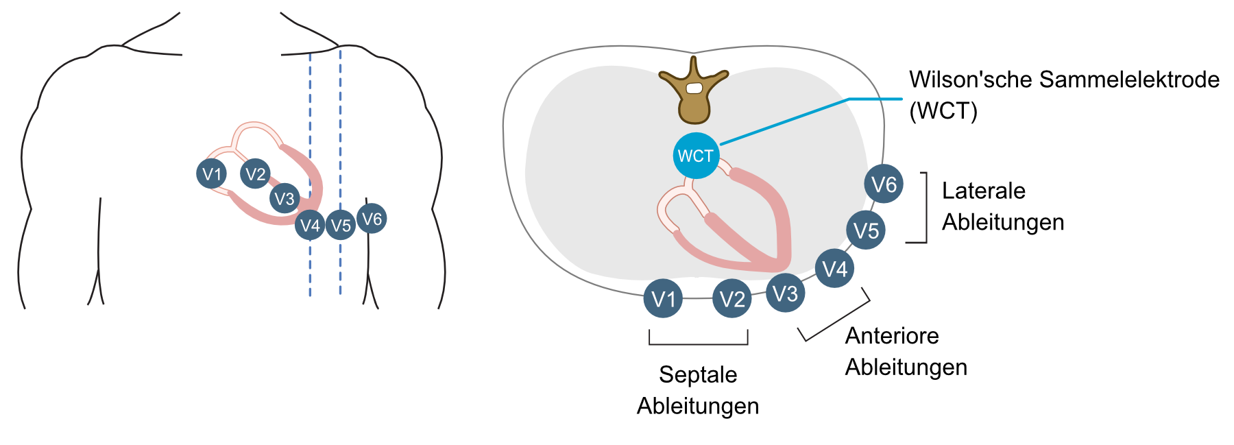 Abbildung 19. Die Brustwandableitungen. Beachte die Wilson