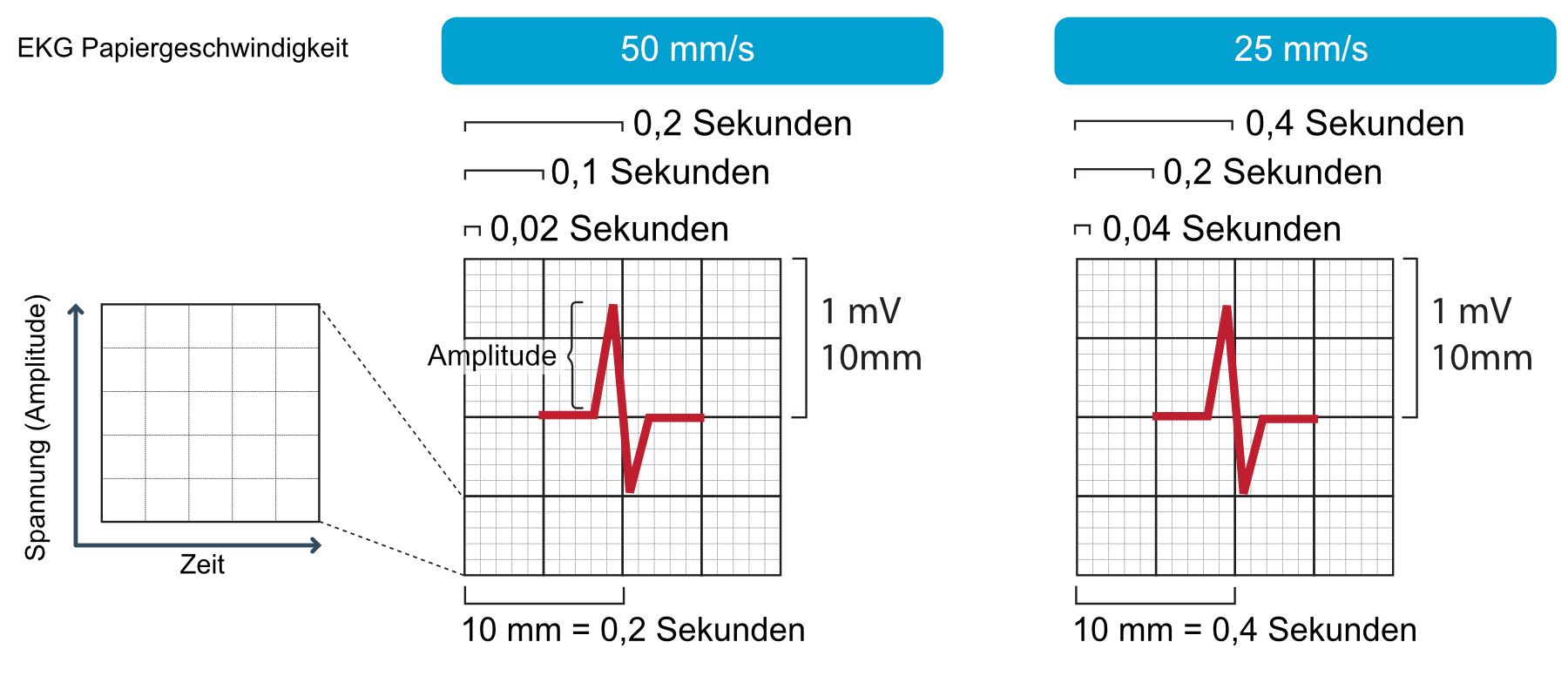 Abbildung 15. Das EKG-Raster.