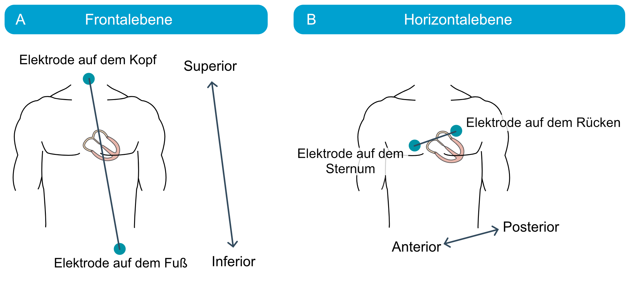 Abbildung 17. Schematische Darstellung der Ausrichtung von Extremitätenableitungen und Brustwandableitungen.