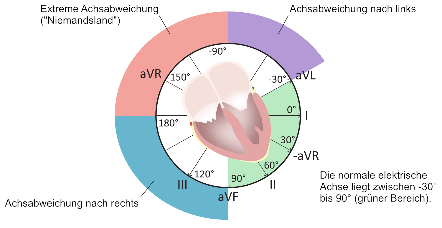 Abbildung 38. Die elektrische Achse des Herzens.