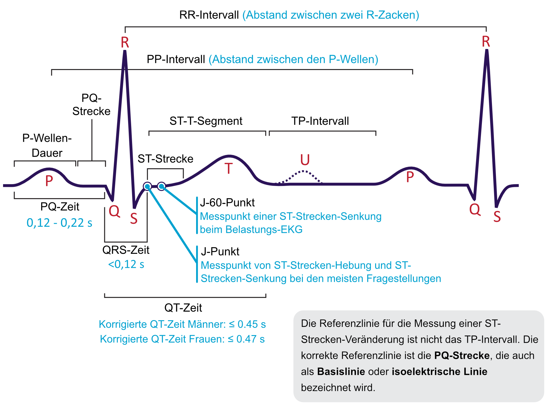 Abbildung 1. Die klassische EKG-Kurve mit den häufigsten Wellenformen. Wichtige Intervalle und Messpunkte sind dargestellt. Die EKG-Interpretation erfordert die Kenntnis dieser Wellen und Intervalle.