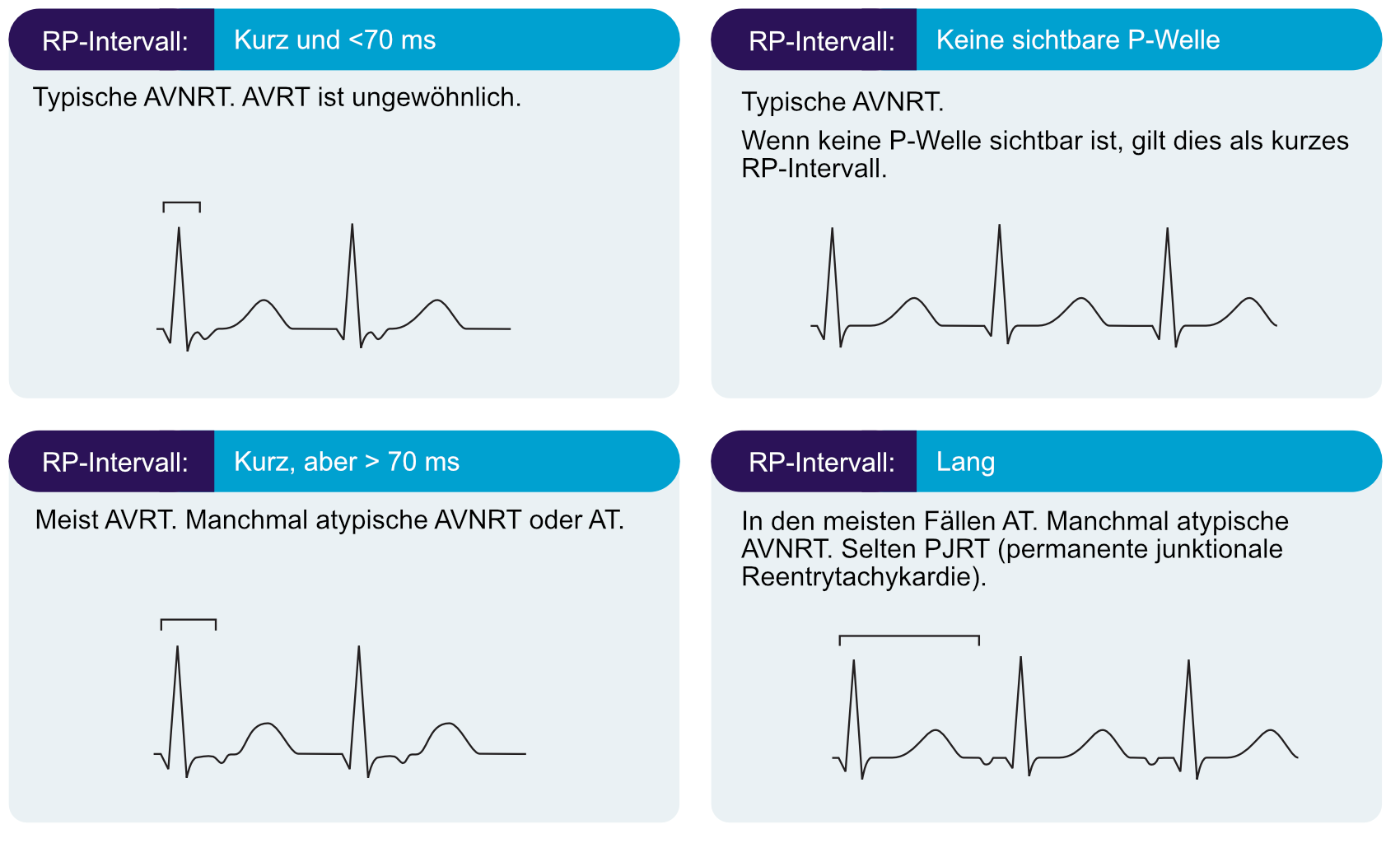 Abbildung 2. Differentialdiagnosen basierend auf dem RP-Intervall.