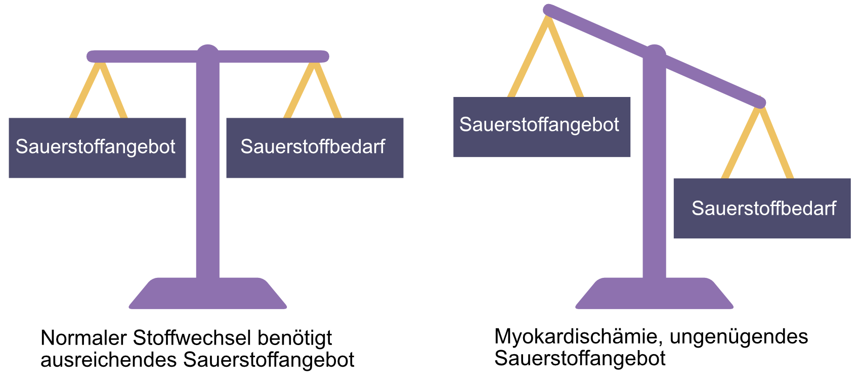 Abbildung 1. Myokardzellen benötigen eine kontinuierliche Sauerstoffversorgung, um einen normalen Stoffwechsel aufrechtzuerhalten. Wenn die Sauerstoffversorgung geringer ist als der Sauerstoffbedarf, entwickelt sich eine Ischämie. Myokardzellen können auf einen anaeroben Stoffwechsel umstellen und die Kontraktionen unterbrechen, um die Ischämie zu tolerieren. Dies ermöglicht der Zelle, eine schwere Ischämie von bis zu 30 Minuten zu überleben. Wenn der Blutfluss innerhalb von 30 Minuten nicht wiederhergestellt wird, stirbt die Zelle. Der Tod von Myokardzellen wird als Myokardinfarkt bezeichnet.