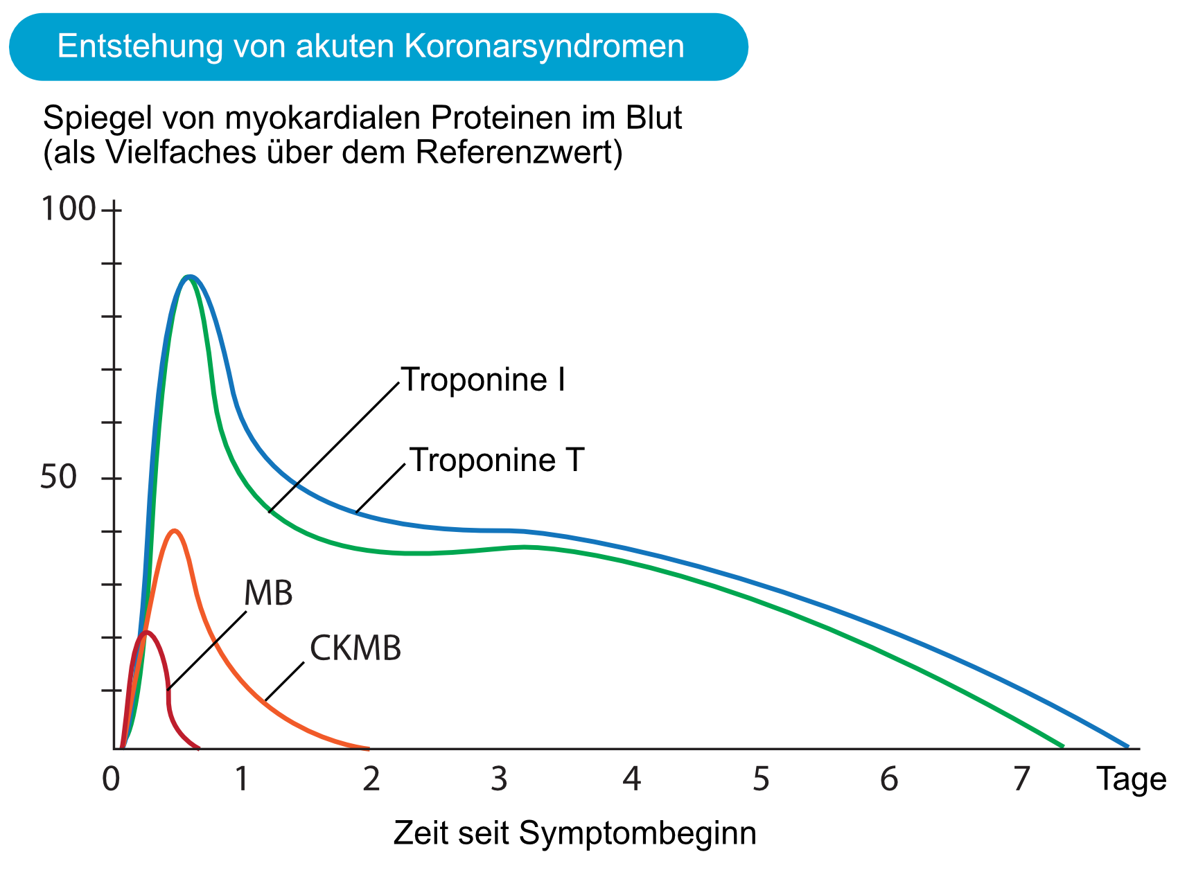 Abbildung 2. Spiegel von Myokardproteinen im Blut nach Myokardinfarkt. Beachten Sie, dass kardiale Troponine nach 24 bis 28 Stunden nach Beginn des Infarkts ihren Höhepunkt erreichen.