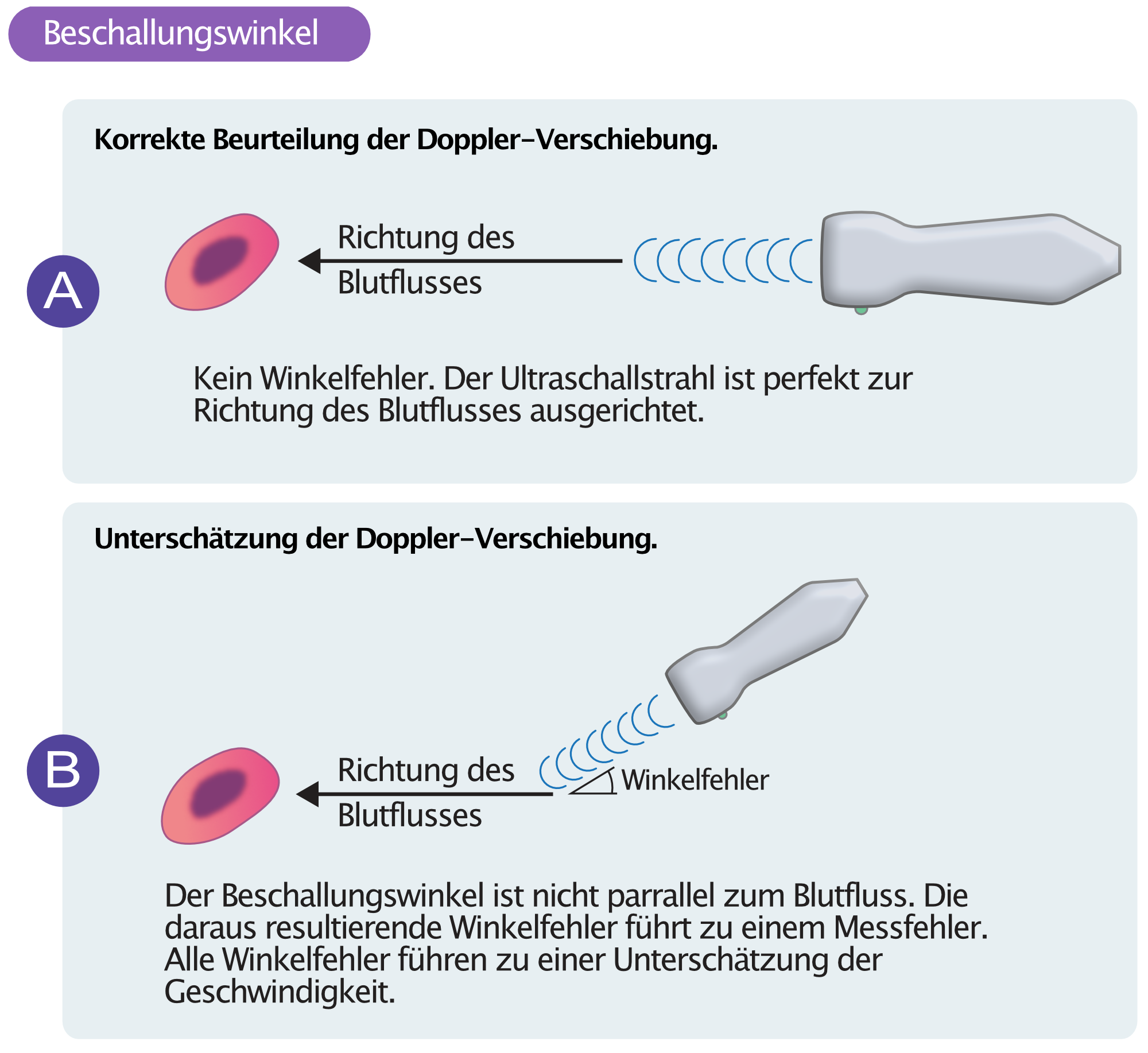 Abbildung 4. Korrekte Beurteilung der Doppler-Verschiebung