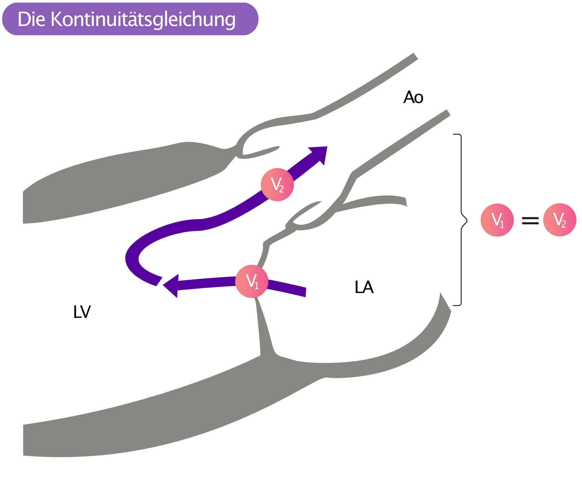 Abbildung 2. Das Prinzip der Kontinuität (die Kontinuitätsgleichung) besagt, dass das Volumen des Blutes, das durch die Mitralklappe fließt, dem Volumen entsprechen muss, das durch die Aortenklappe fließt.