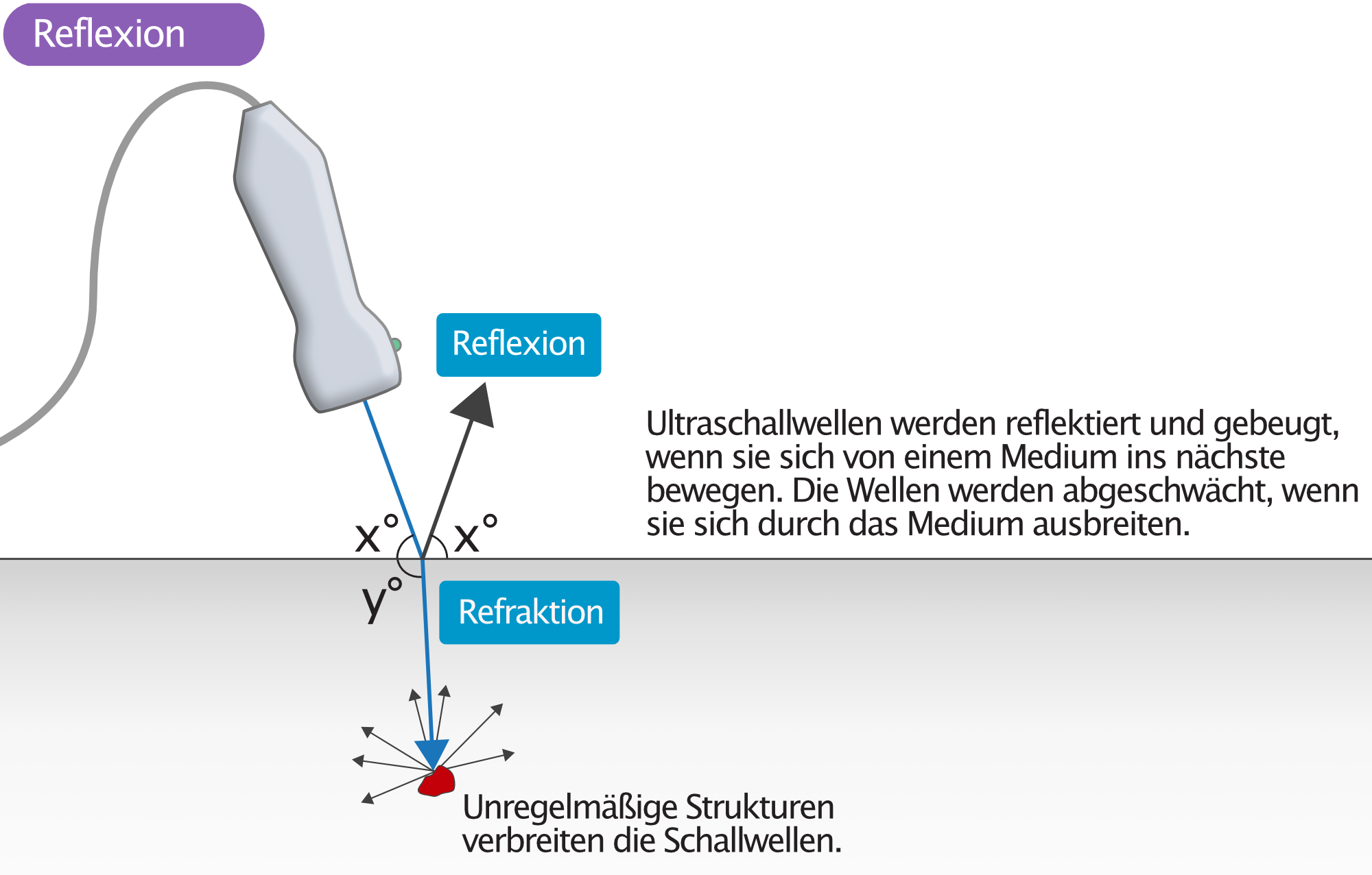 Abbildung 4. Reflexion und Brechung von Ultraschallwellen.