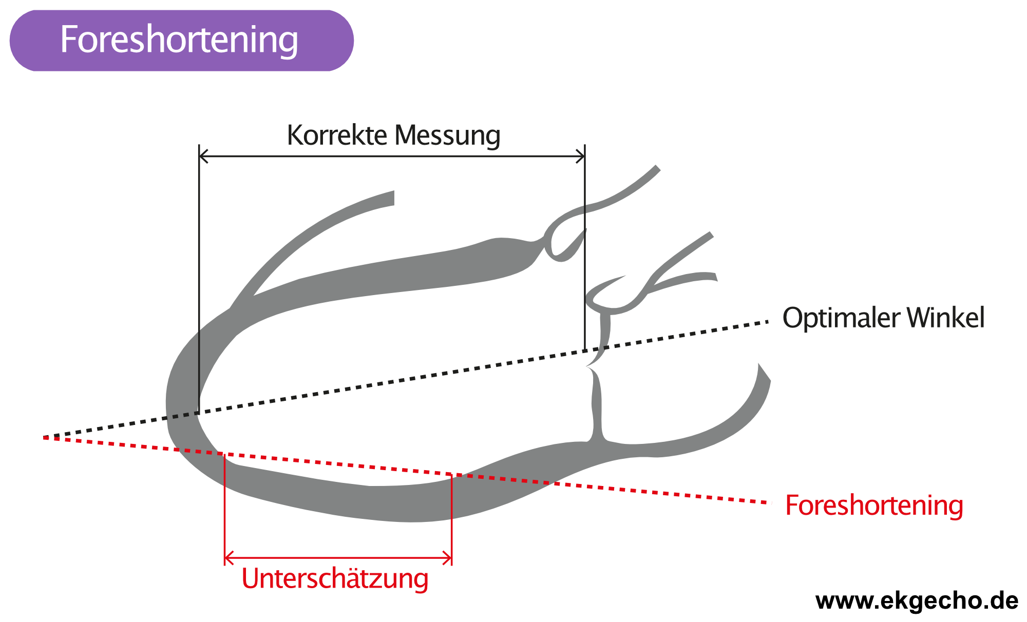 Abbildung 4. Foreshortening.