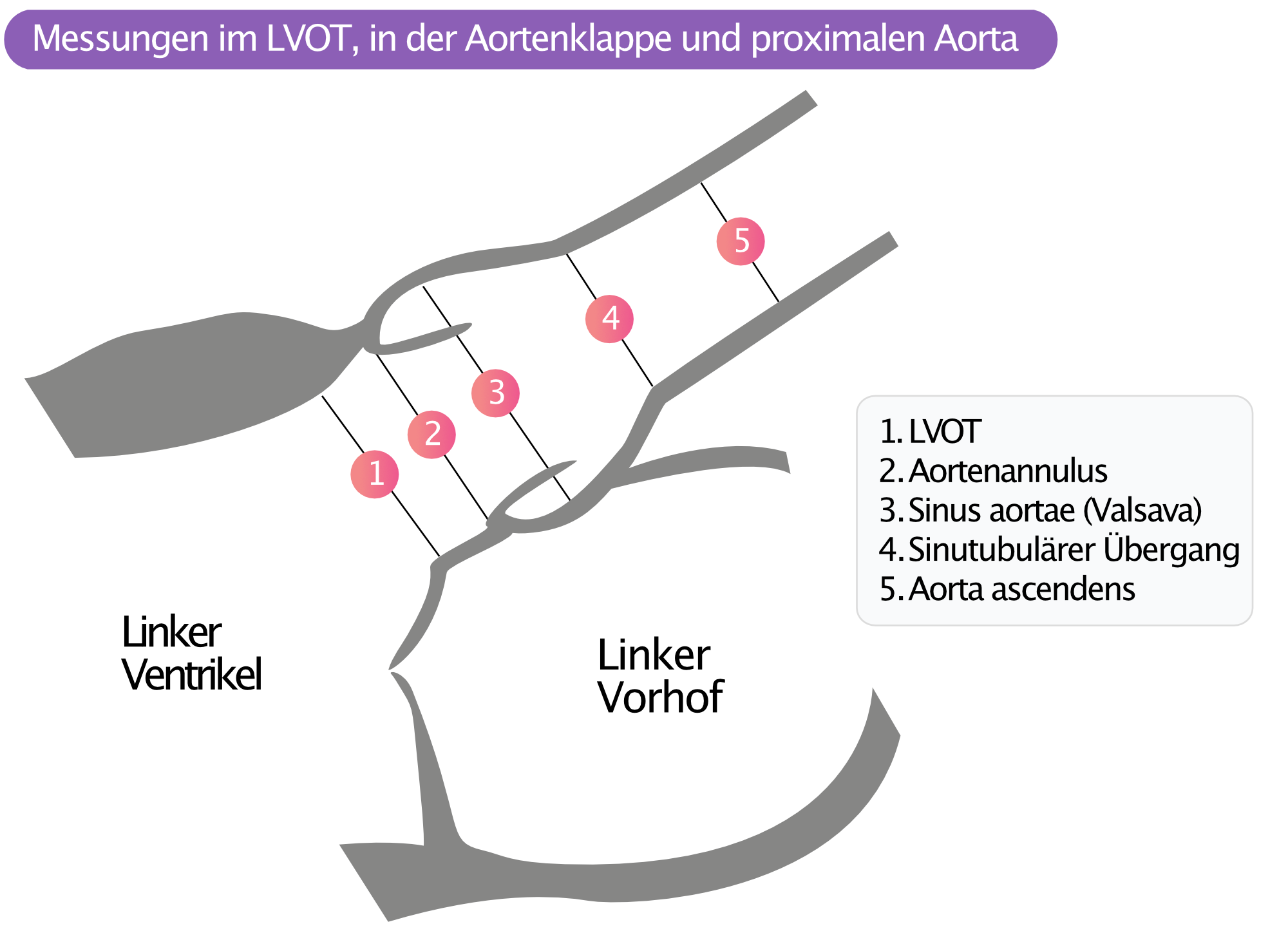 Abbildung 6. Messungen in LVOT, Aortenklappe und proximaler Aorta.