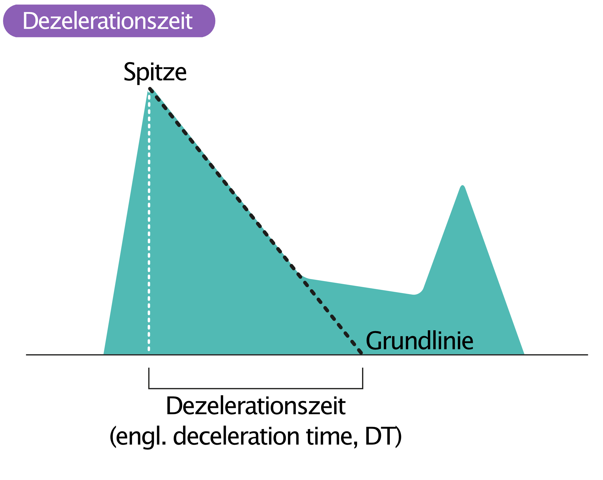 Abbildung 2. Dezelerationszeit (engl. deceleration time, DT).