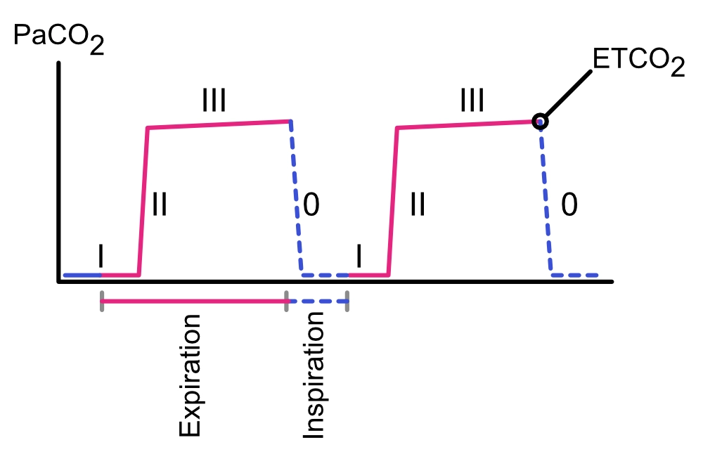 Normales Kapnogramm mit den Phasen 0, I, II und III