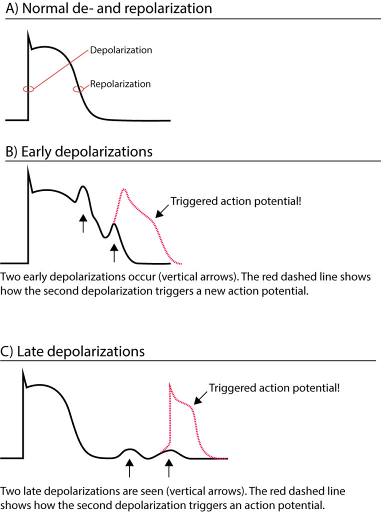 Mechanisms of cardiac arrhythmias: from automaticity to re-entry (reentry)