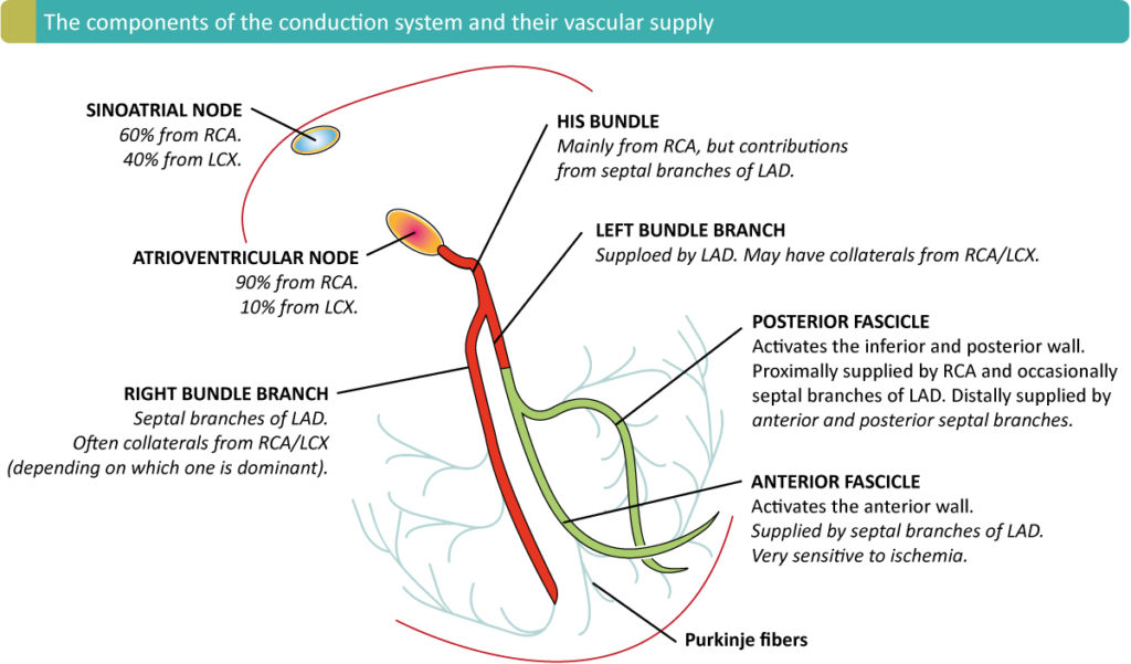 Figure 1. The component of the cardiac conduction system and the vascular supply. RCA = right coronary artery. LAD = Left anterior descending coronary artery. LCX = left circumflex coronary artery.