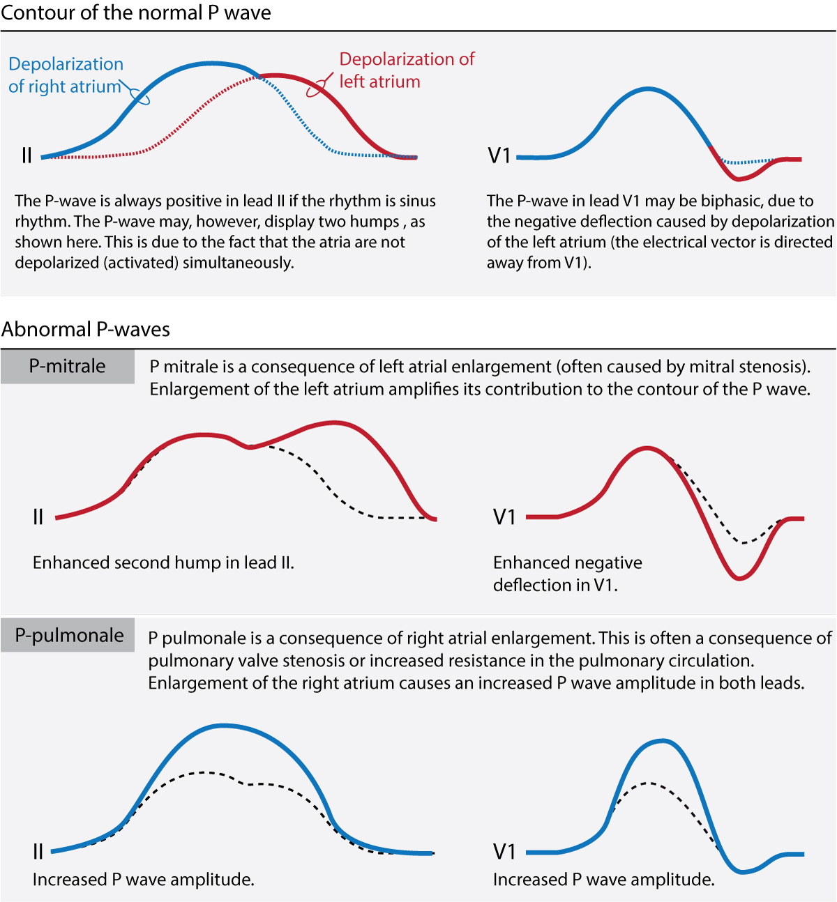 What Does Borderline T Wave Abnormalities Mean