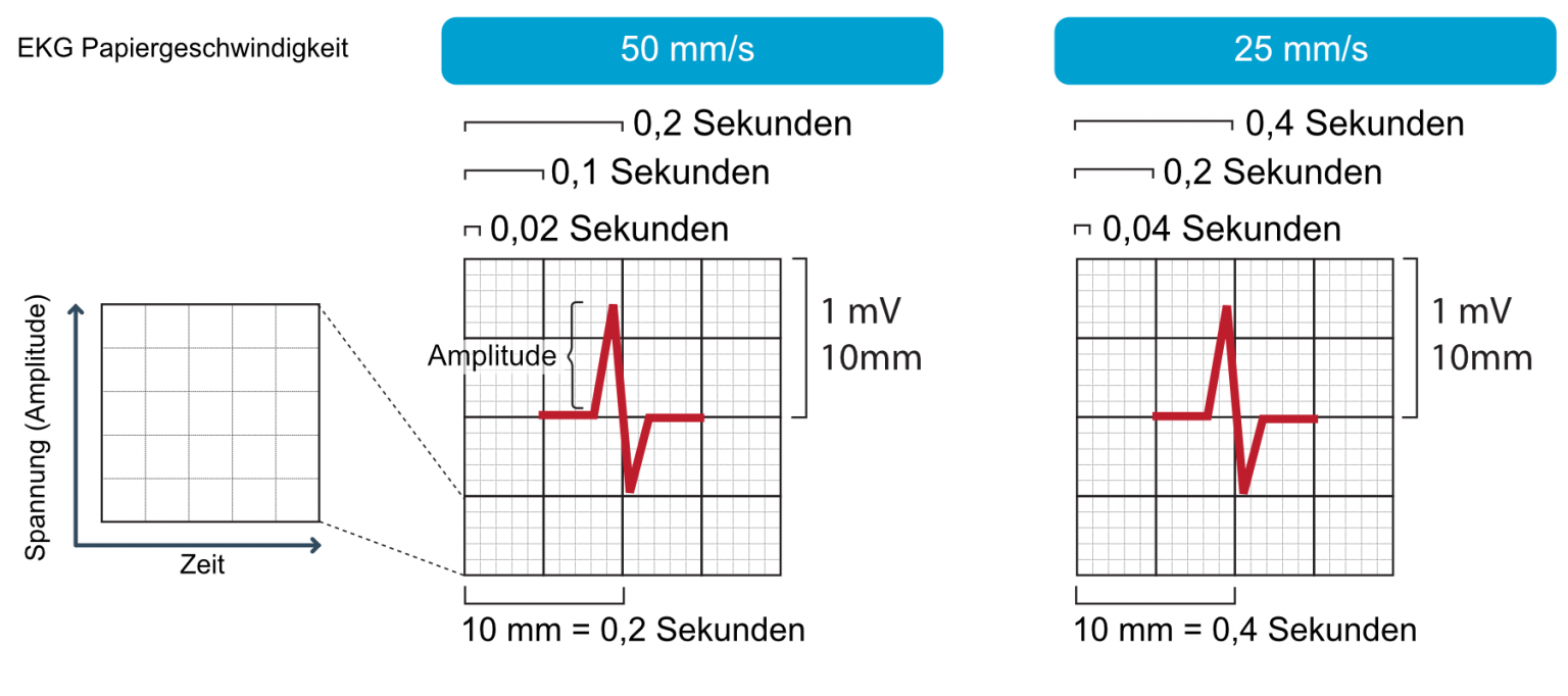 Wie Viel Ms Sind Eine S ekgecho.de