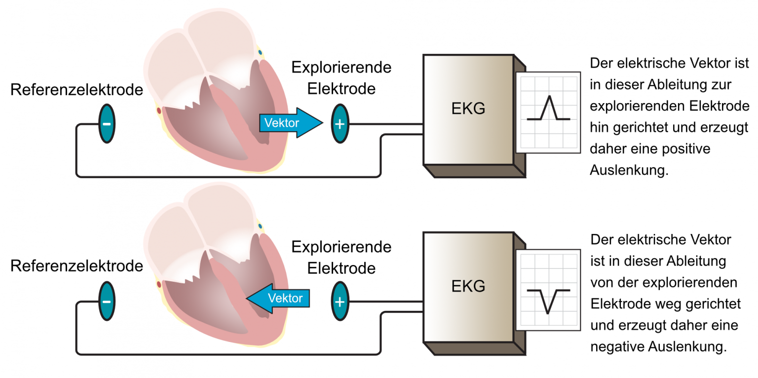 Wie Wird Ein Ekg Gemacht