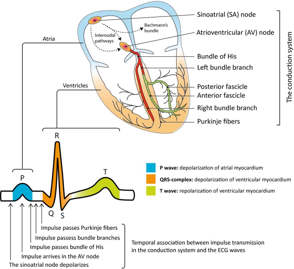 Figure 1. The cardiac cycle starts when cells in the sinoatrial node discharges an action potential that spreads as an electrical impulse through the atria and – via the atrioventricular node – to the ventricles. As the impulse spreads through the myocardium, it activates the cells which respond by contracting. The action potential generates electrical currents which gives rise to the classical ECG waveforms presented here. Activation of the atria is reflected as the P-wave and activation of the ventricles results in the QRS complex. The T-wave reflects the recovery (repolarization) of the ventricles. Note that the ECG rarely shows atrial recovery (repolarization) since it coincides with ventricular depolarization (i.e QRS complex), which has much stronger electrical potentials.