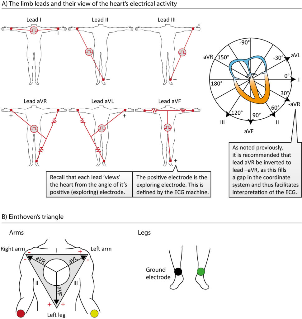 Figure 18. The organization of the limb leads. Note that the electrode on the right leg is not included in any lead, but serves as a ground wire. Leads I, II and III are Einthoven's original leads, and they can be presented with Einthoven's triangle (lower panel). Leads aVR, aVL and aVF were constructed by Goldberger; their reference point is the average of two electrodes. Lead aVR can be inverted into lead –aVR which is recommended as it may facilitate interpretation. All modern ECG machines are capable of presenting both aVR and -aVR.