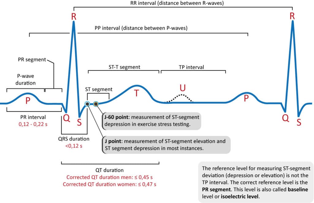 The normal electrocardiogram (ECG) waves. ECG interpretation.