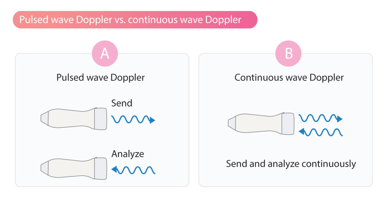 ContinuouswaveDoppler EKG & ECHO