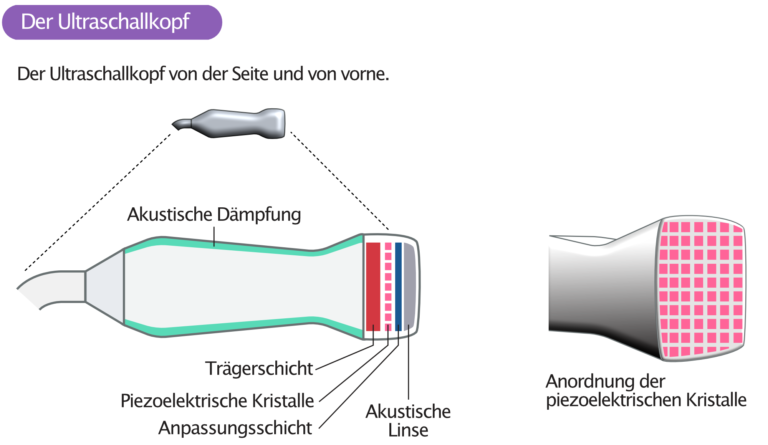 Der Ultraschallkopf – Kardiovaskuläre Medizin Online